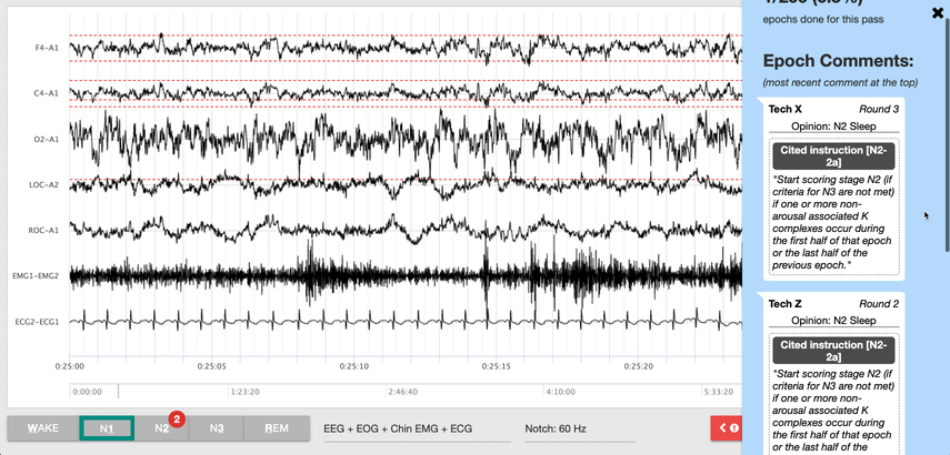 CrowdEEG Adjudication Interface